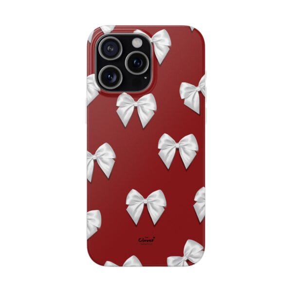 Chic Bow-Patterned Flexi Case for Stylish Protection - Image 212